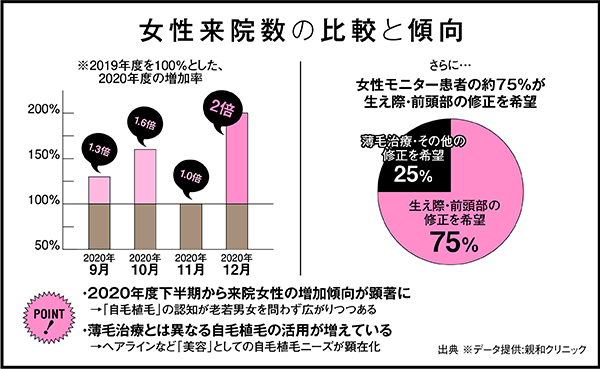 自毛植毛