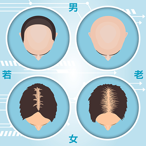 自毛植毛｜髪は「増えればいい時代」から「人生を変える時代」へ　〜自毛植毛で未来を切り拓いた老若男女たち〜