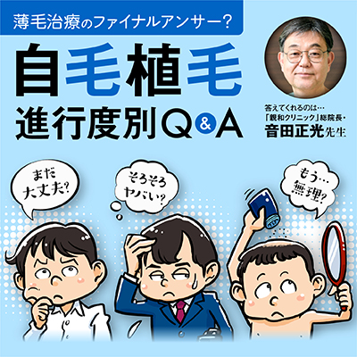 植毛｜【薄毛のステージ別】自毛植毛に関する15の疑問